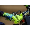 Kép 9/10 - Acerbis X-Force Kézvédő (7 színben)